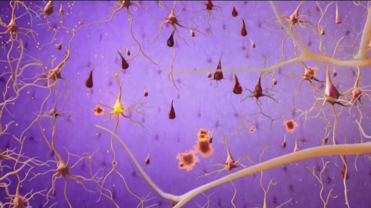 El uso excesivo de las nuevas tecnologías reduce nuestra capacidad de pensamiento