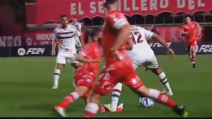 Lesión grave provocada por Marcelo / TELEMADRID