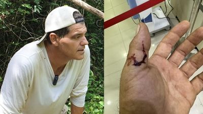 Frank Cuesta, en el hospital tras sufrir "la peor mordedura de víbora posible"