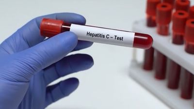 España podría ser el primer país en erradicar la hepatitis C, antes de 2030