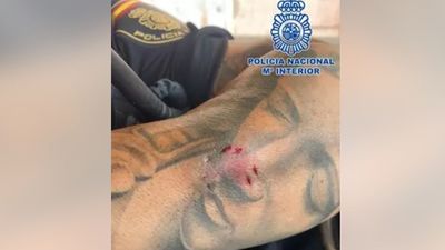 Una mujer muerde a dos policías cuando iba a ser detenida por agredir a su marido con un cuchillo