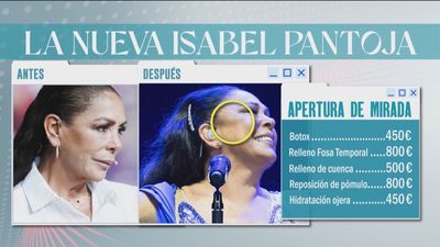La nueva Isabel Pantoja: ¿Cuánto se ha gastado en su última cirugía facial?