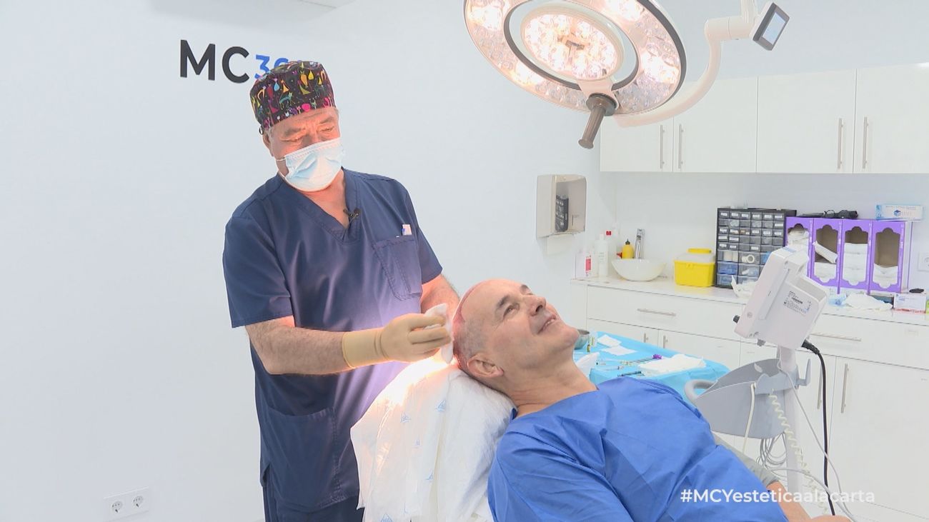 ¿Cómo se realiza un injerto capilar?