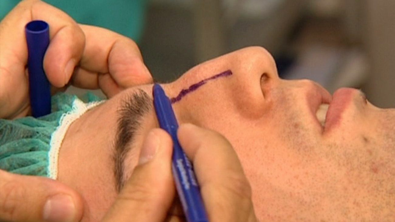 La sanidad privada impulsa la cirugía estética: crece un 215 % en 7 años