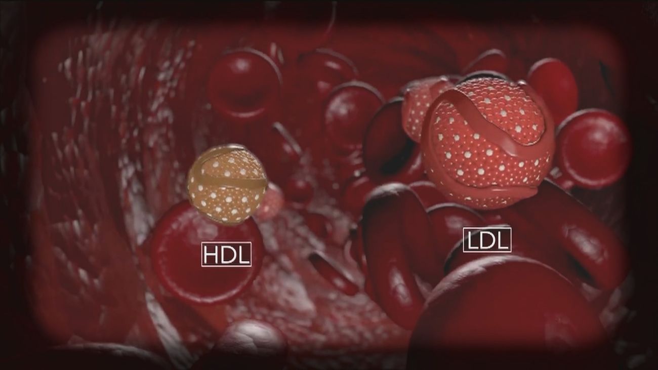 Sanidad aprueba un fármaco que reduce el colesterol con dos dosis al año