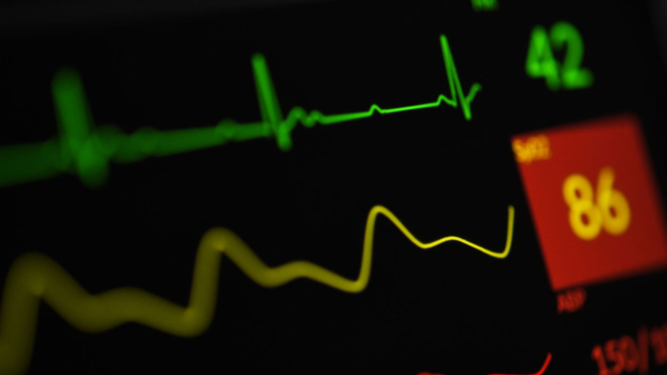 Las mujeres tienen más probabilidad de morir por un infarto agudo que los hombres, según una experta