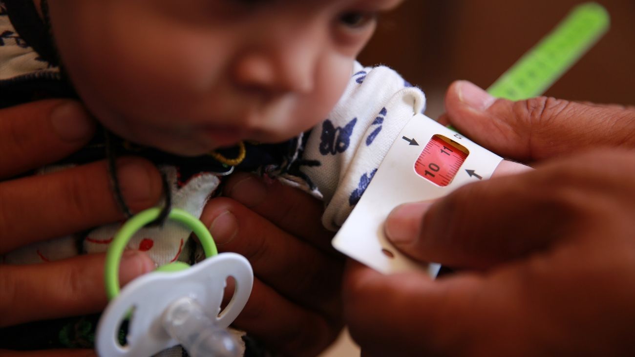 Medición del nivel de desnutrición de una niña en Afganistán