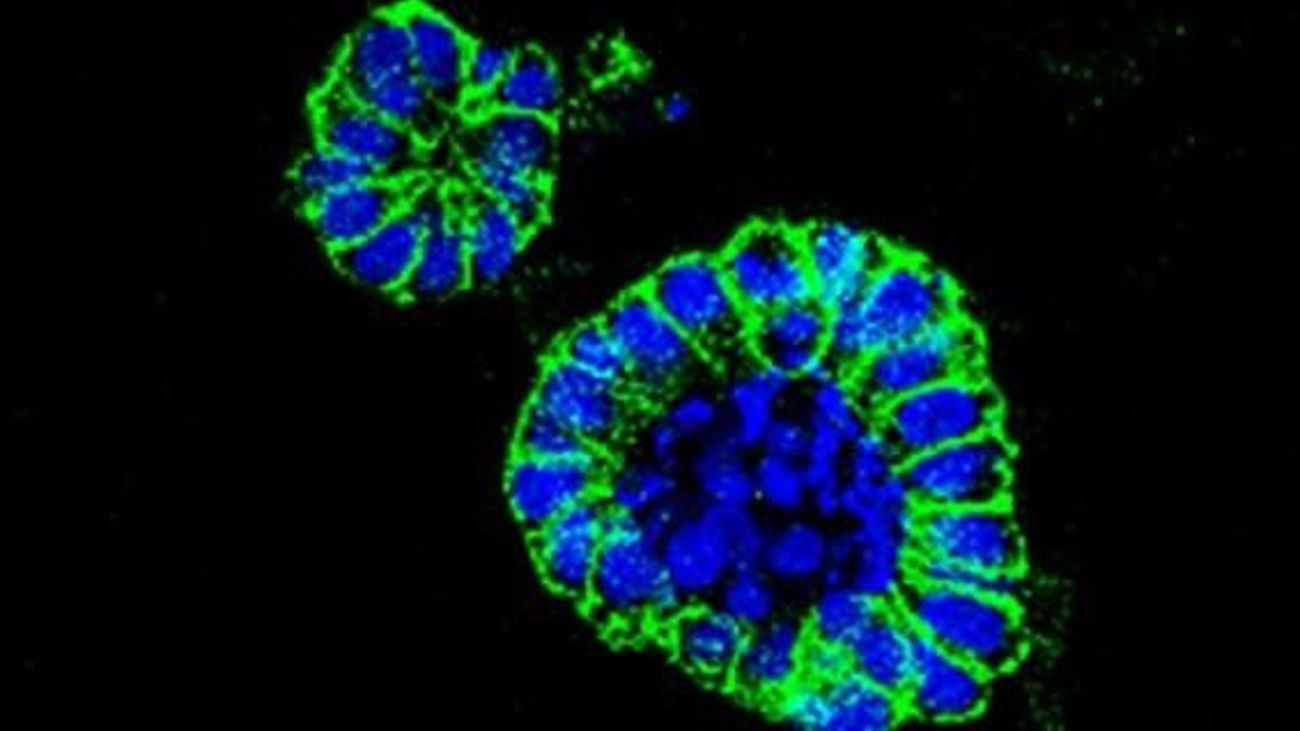 Muestran la eficacia de un nuevo fármaco para tratar el cáncer de colon