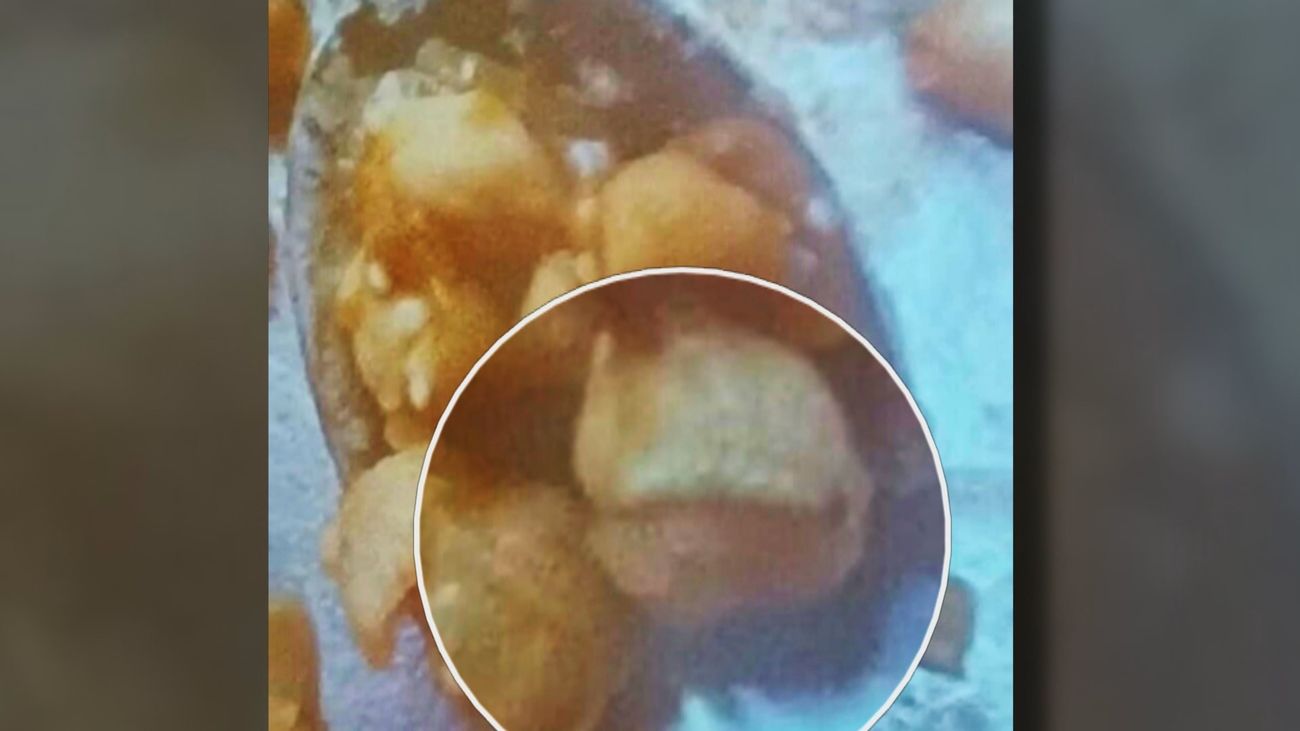 Detectan gusanos en la comida de un colegio del distrito de Usera