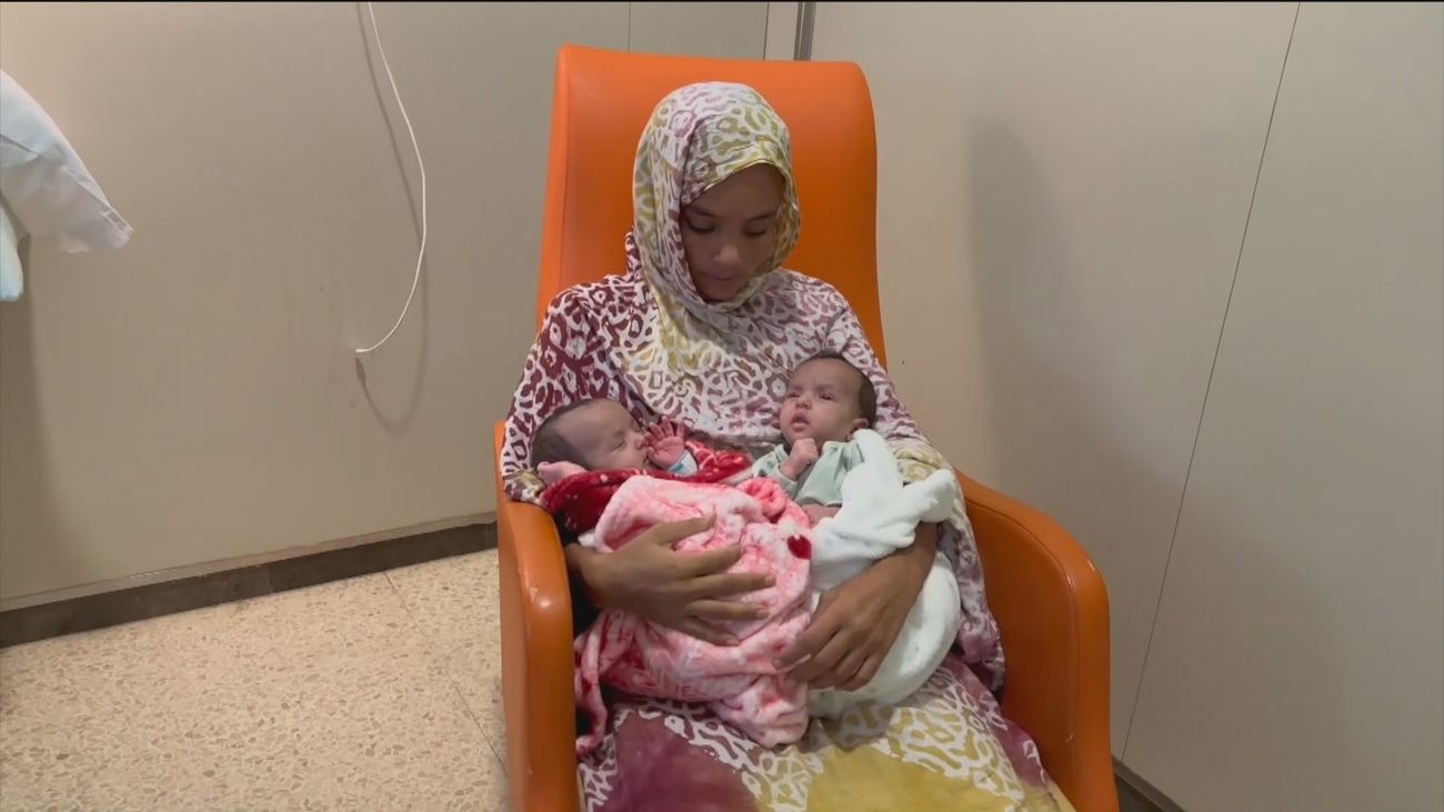 Las dos siamesas de Mauritania evolucionan tras ser separadas hace 9 días