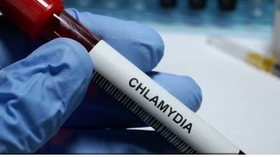 Alertan de un aumento "preocupante" de enfermedades de transmisión sexual en Europa