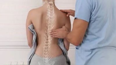 Ejercicios e higiene postural para evitar lesiones y fortalecer la espalda