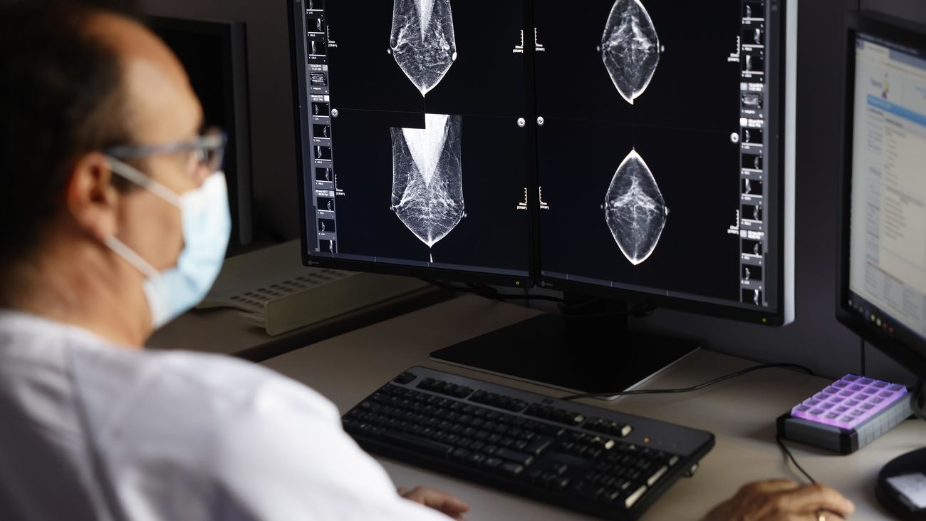 Análisis de imágenes de mamografías en el Hospital Santa Cristina de Madrid