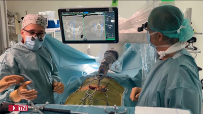 La Paz cuenta con el primer brazo robótico para operaciones de columna vertebral de España