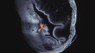 Logran reducir tumores de vejiga con nanorrobots que transportan el fármaco