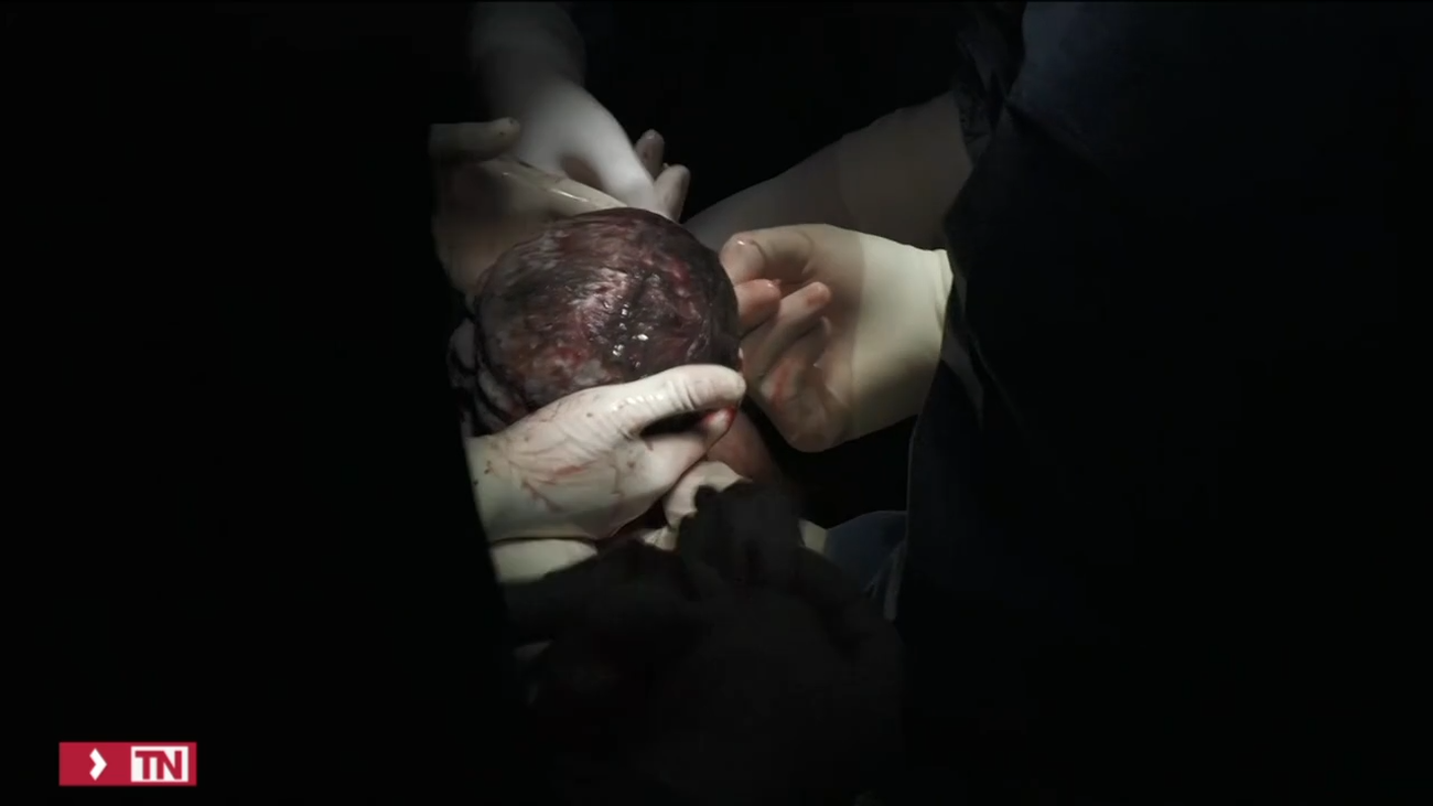 Nace un bebé de la segunda mujer trasplantada de útero en España