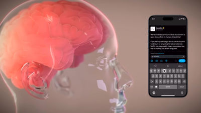 Elon Musk anuncia que se ha implantado el primer chip cerebral en un ser humano