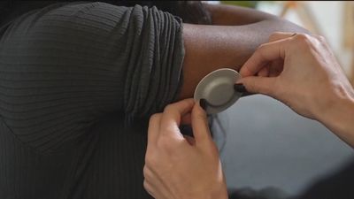 Un parche adherido a la piel, para controlar en tiempo real la diabetes