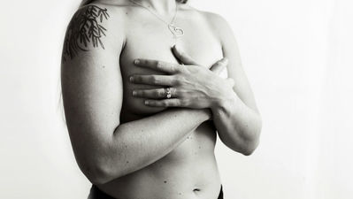 Identifican una nueva diana terapéutica contra el cáncer de mama