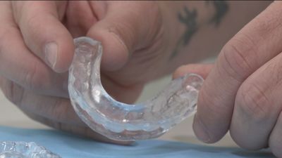 Cientos de afectados en toda España a causa de los alineadores invisibles publicitados en redes sociales