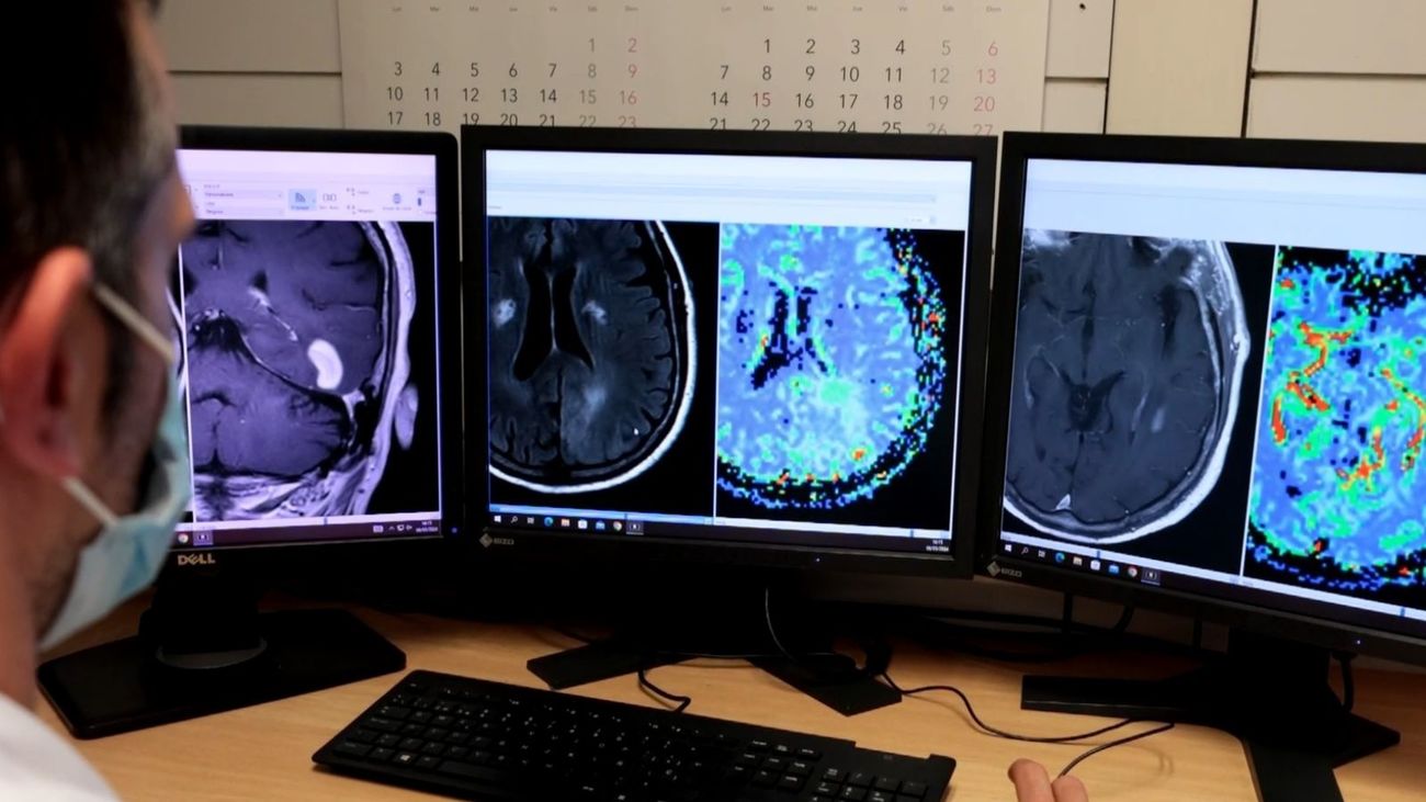 Imágenes de resonancia magnética de cerebro en el Hospital Universitari de Bellvitge (HUB), que ha colaborado con los investigadores del Vall d'Hebron Institut d'Oncologia (VHIO)