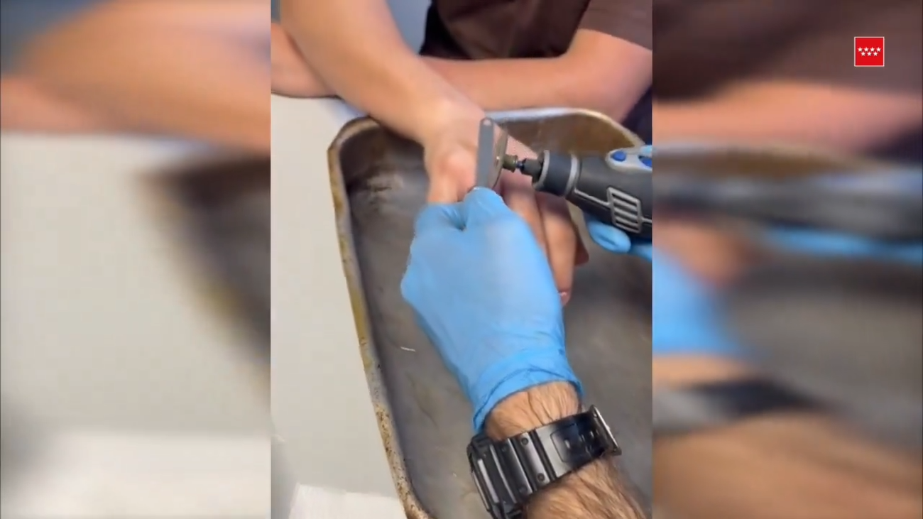 Bomberos consiguen liberar el dedo de una persona atrapado por un anillo