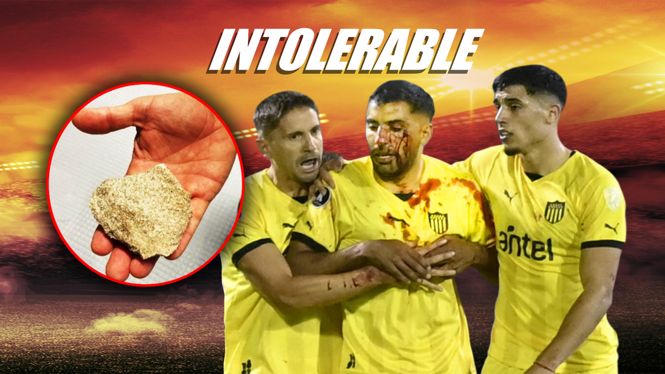 Así quedó Maxi Olivera tras una pedrada en la cara de la afición de Rosario Central