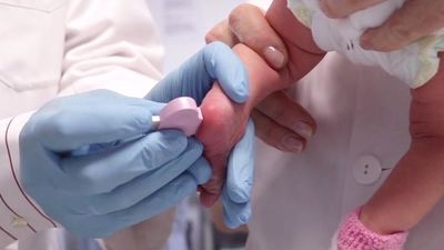 La prueba del talón pasará a predecir de 7 a 11 enfermedades en los recién nacidos