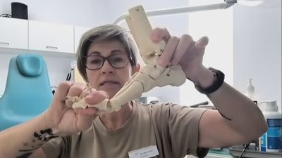 ¿Qué es el neuroma de Morton que afecta a la reina Letizia?