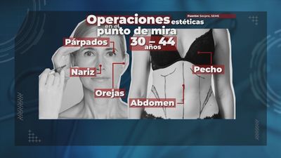 Sanidad impedirá que médicos sin especialidad de cirugía estética realicen intervenciones de este tipo