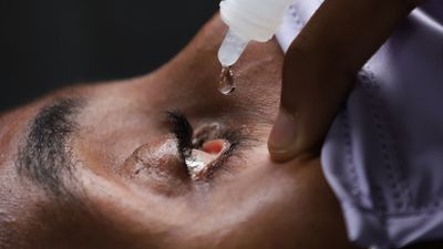 Sanidad financia 'Roclanda',  el primer colirio contra el glaucoma