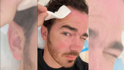 Kevin Jonas alerta a sus fans por un problema de salud
