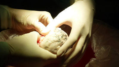 La Paz, los grandes hitos de un hospital pionero