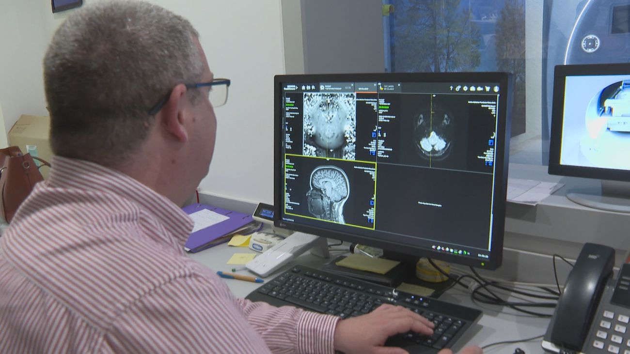 Una nueva máquina de resonancia magnética permite la detección precoz de enfermedades neurológicas