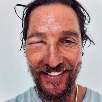 Matthew McConaughey publica una fotografía con el rostro deformado / Matthew McConaughey