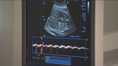 Los médicos de Madrid podrán acceder a todas las imágenes de diagnóstico e historial de sus pacientes