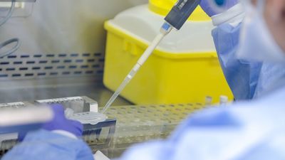 ¿Qué es, cómo se transmite y cuáles son los síntomas de la viruela del mono?