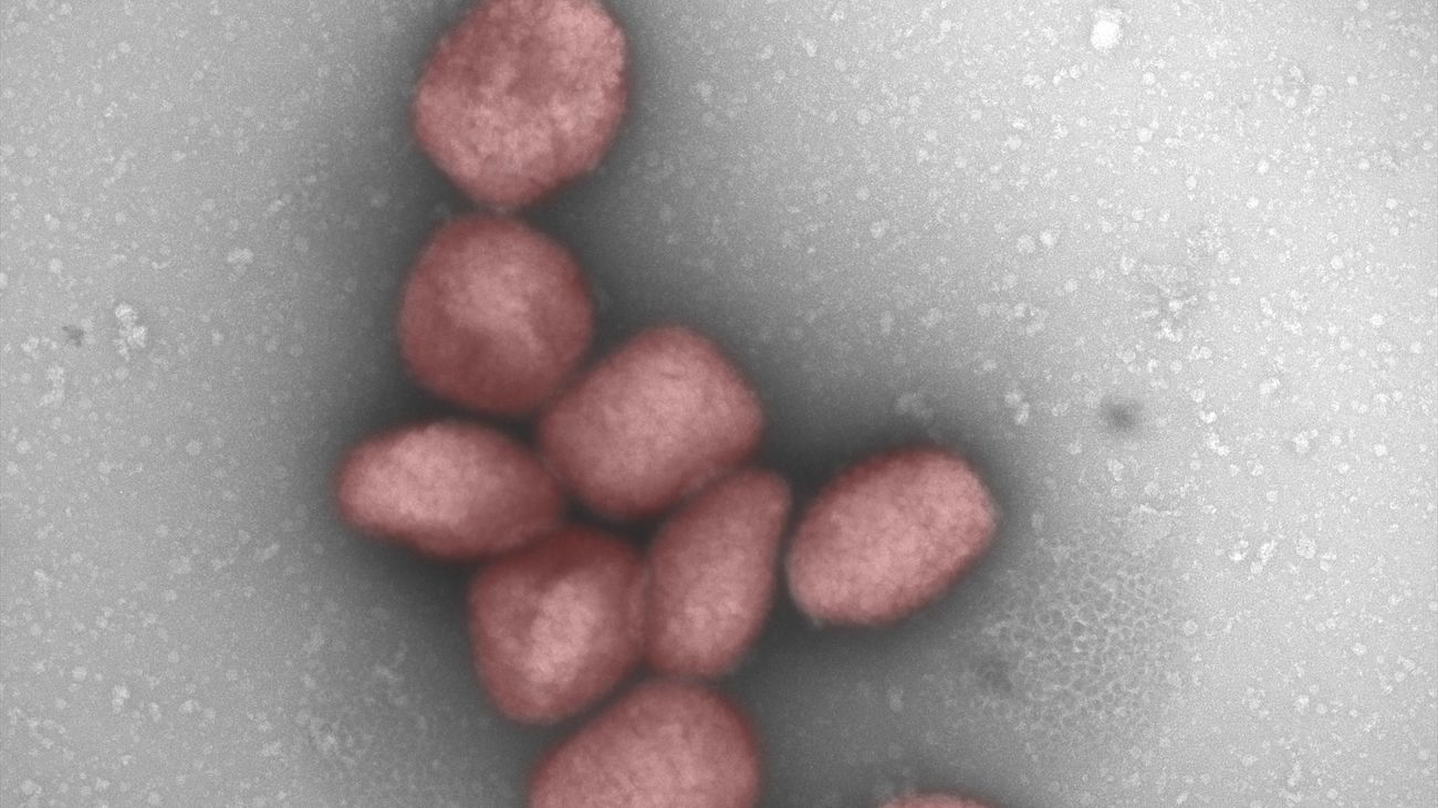 El Comité de Seguridad Sanitaria de la UE "no recomienda" el control en las fronteras por la viruela del mono