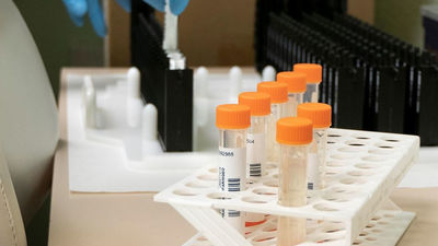 Madrid registra 153 casos de mpox (viruela del mono) en lo que va de año, el 93% de transmisión sexual