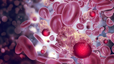 Los cánceres sanguíneos, el quinto tumor más frecuente en España