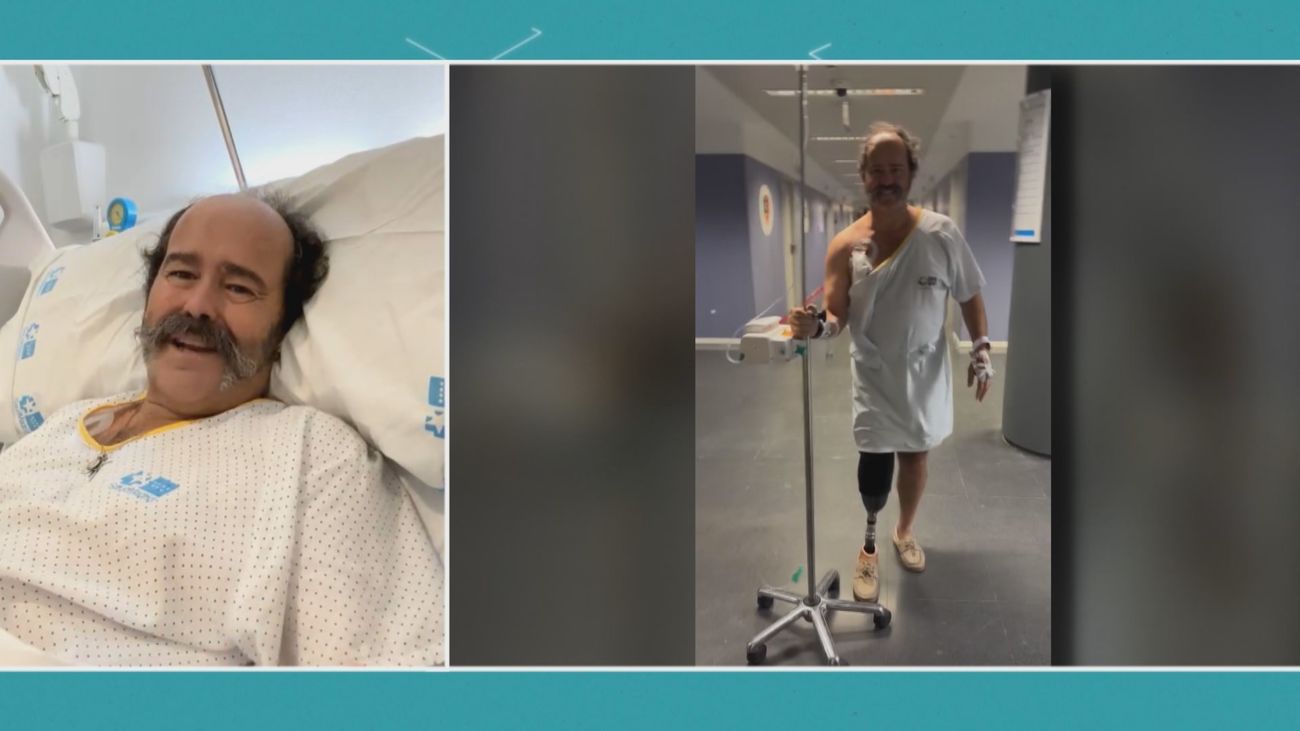 30 operaciones y una amputación: Así es la historia de superación de Pablo Delgado