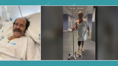 30 operaciones y una amputación: Así es la historia de superación de Pablo Delgado