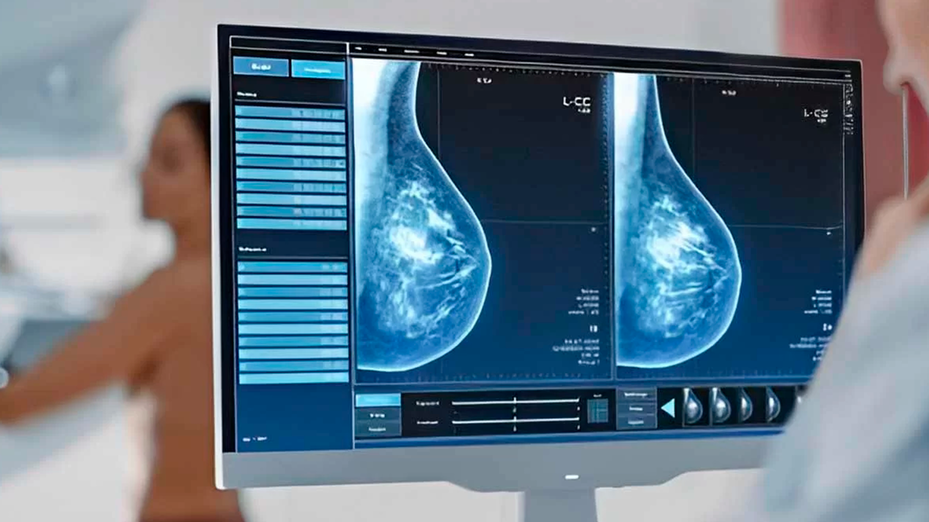 El cáncer, la principal causa de muerte en España en 2024 con más de 115.000 fallecidos