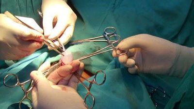 El extraño caso del hombre que tenía tres penes y no lo sabía