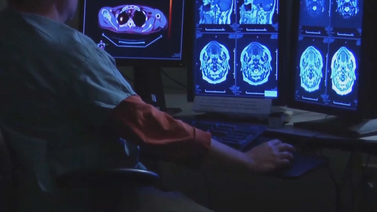 Una linterna molecular para detectar daños y tumores en zonas profundas del cerebro