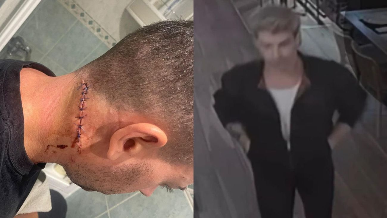 Detenidos los autores de una brutal agresión a dos hombres en Torrelodones