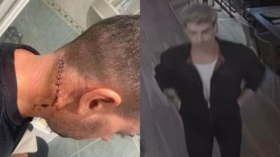 Detenidos los autores de una brutal agresión a dos hombres en Torrelodones