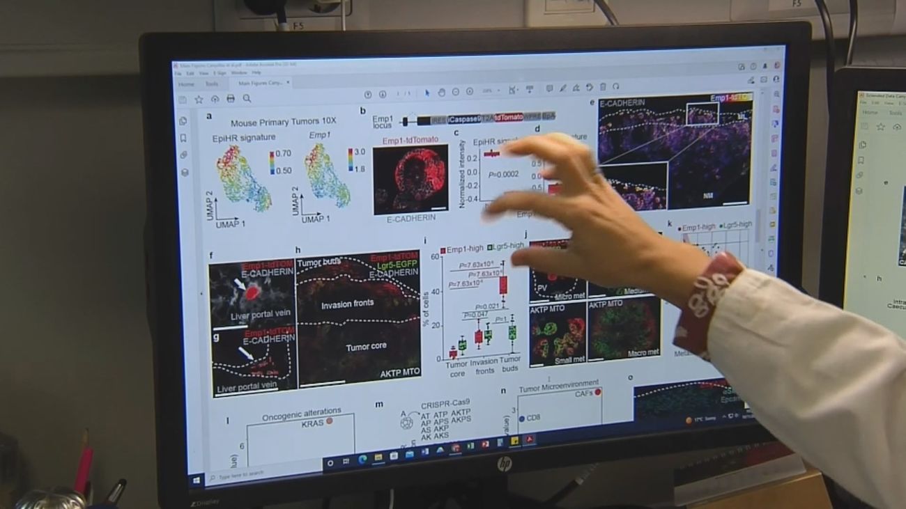 Las cifras del cáncer en 2025: aumentarán los casos, cerca de 300.000,  pero descenderá su mortalidad