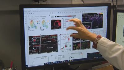 Las cifras del cáncer en 2025: aumentarán los casos, cerca de 300.000,  pero descenderá su mortalidad