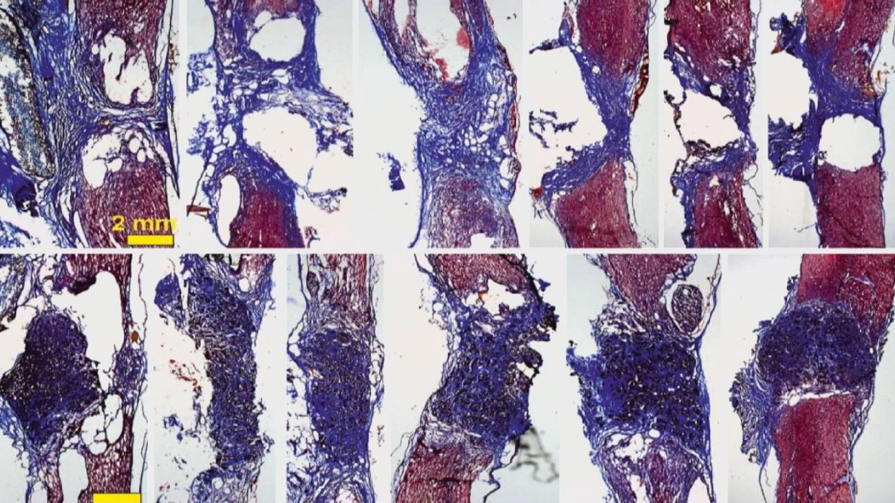 Avance científico 'made in Madrid': espuma de grafeno para poder curar lesiones medulares